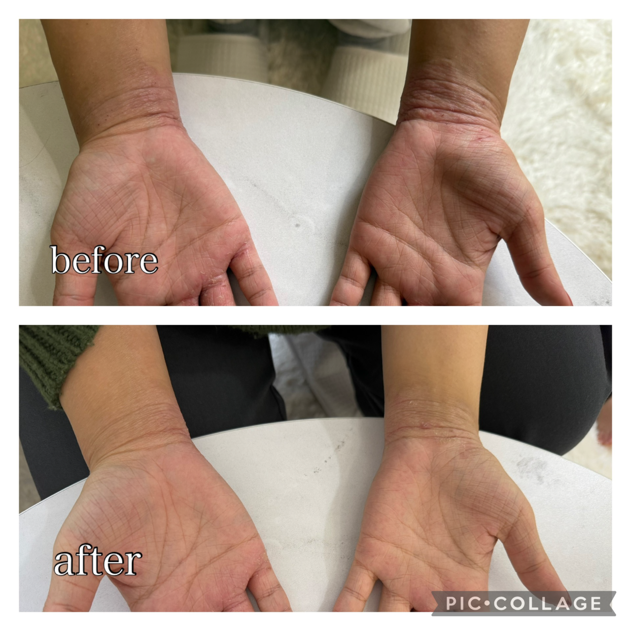 箕面のエステサロンセルラムフェイシャルケア・ビフォアー/アフターNO.1