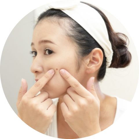 セルラムフェイシャルエステ【ニキビケア】