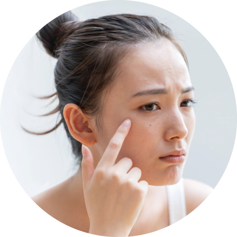 セルラムフェイシャルエステ【シミ・肝斑ケア】